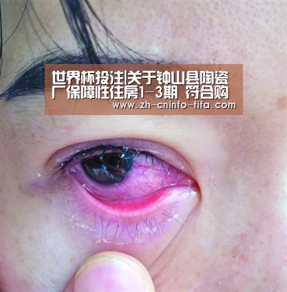 世界杯外围买球